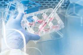 Były kochanek chce testów DNA po latach - co zrobić?